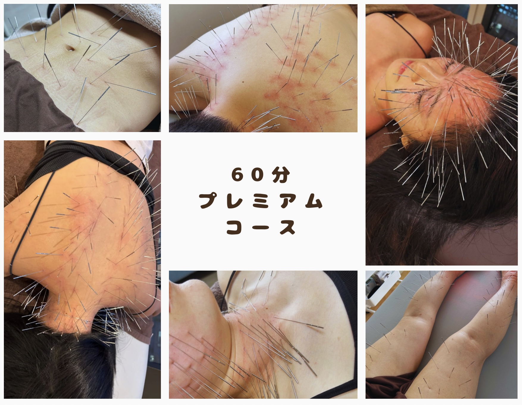 鍼処 桃 プレミアムコースのメニュー画像