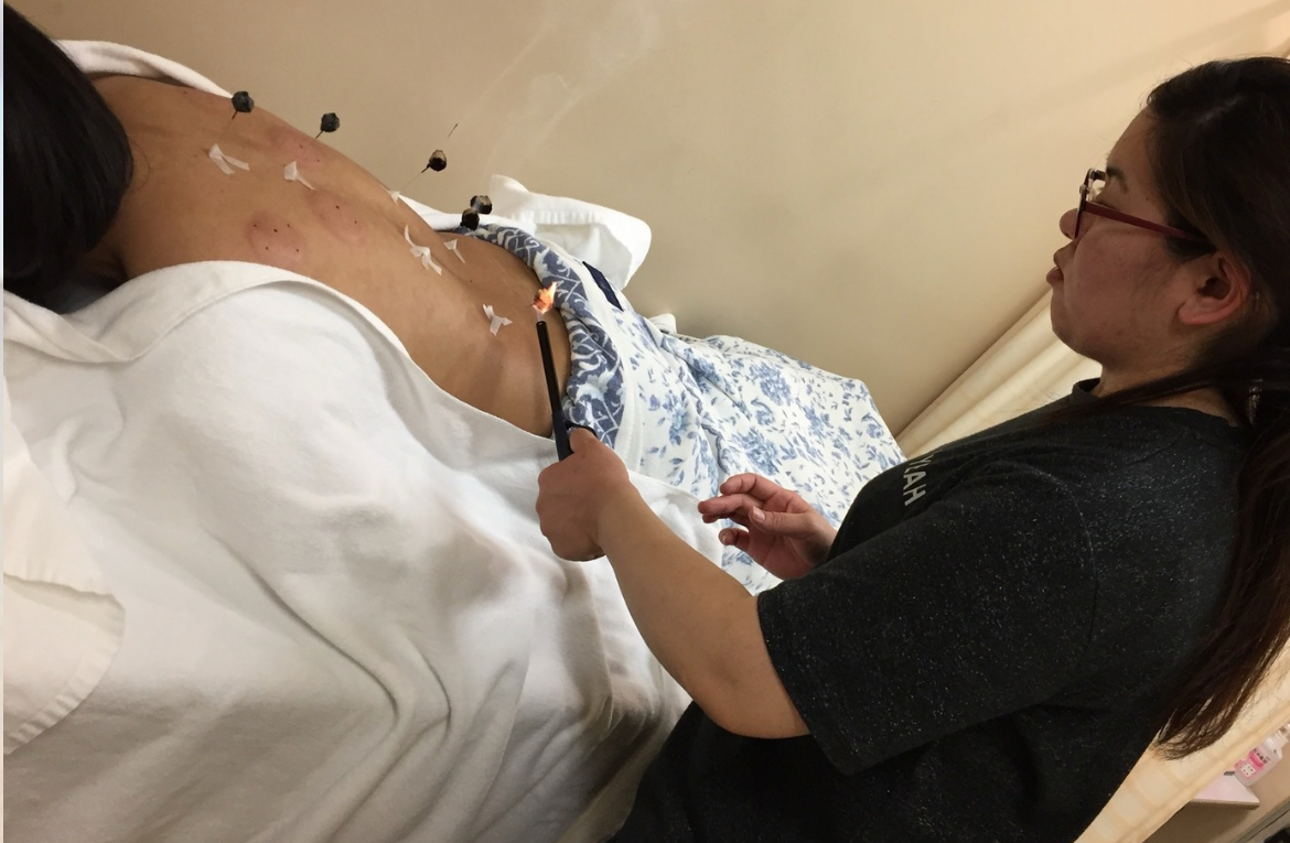 那覇鍼灸サロンrepos［ルポ］ 《身体ケアNo.1》鍼灸＋全身調整のメニュー画像