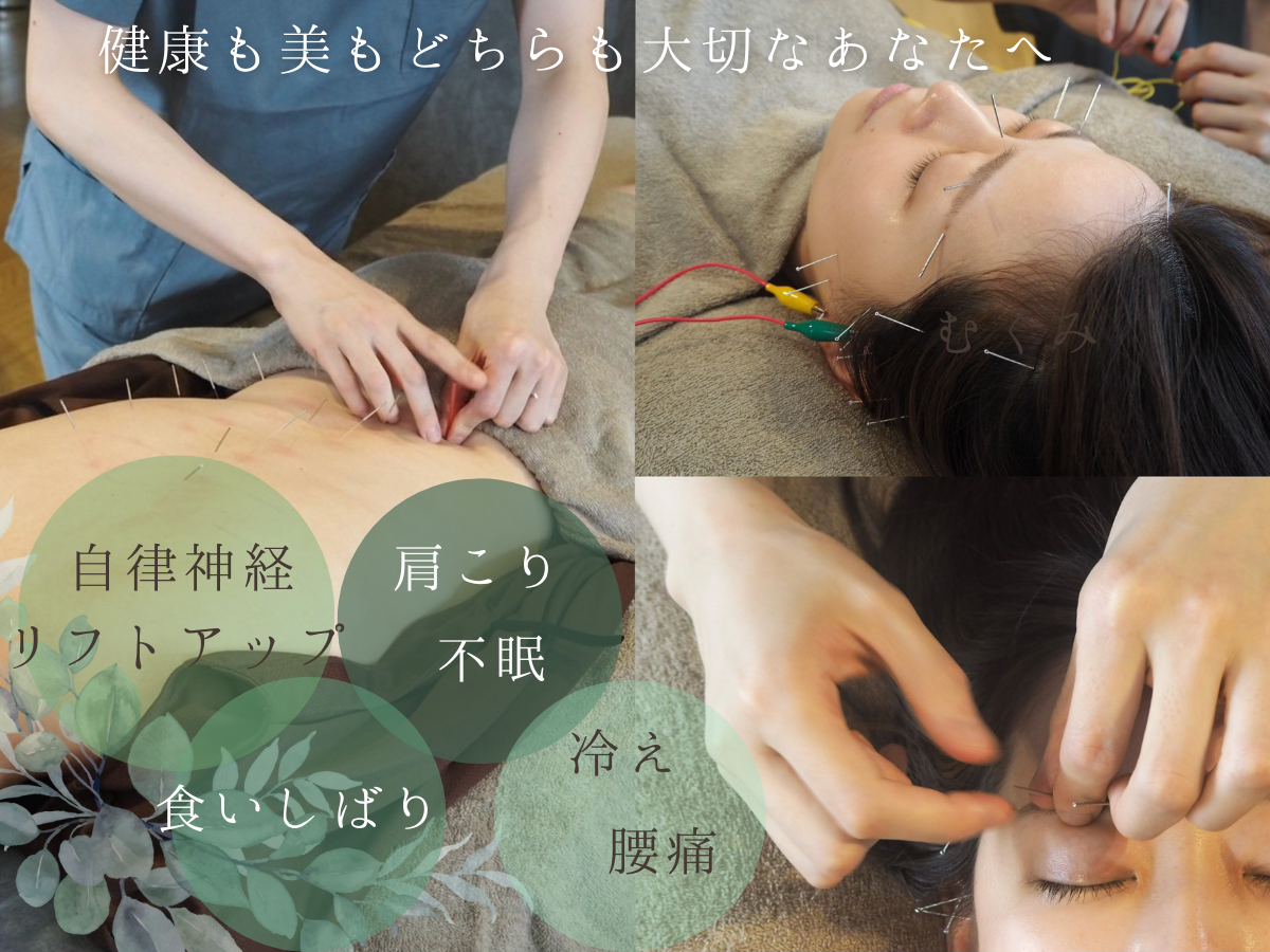はりきゅう きざし 美容鍼（顔＋全身）のメニュー画像