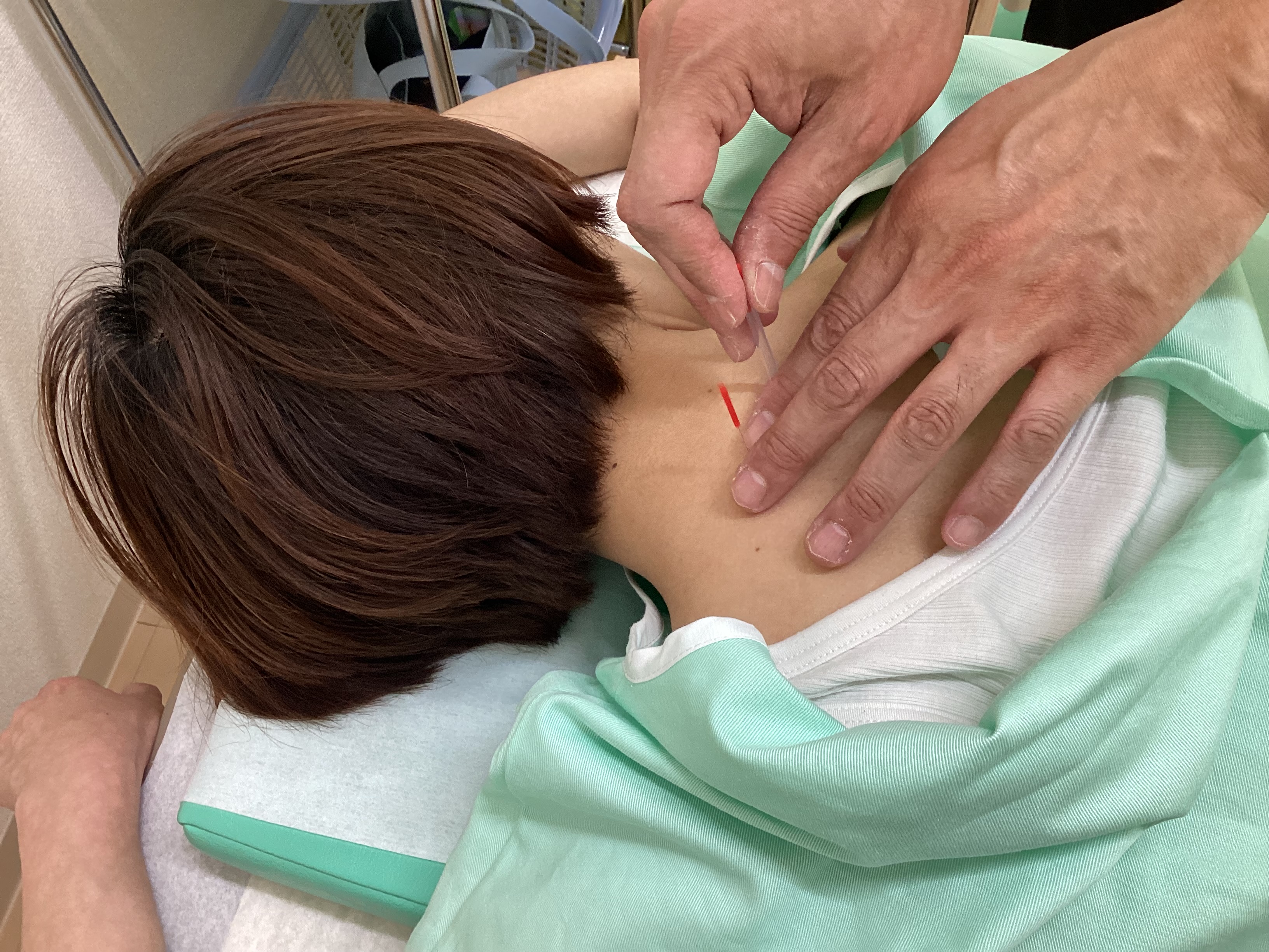 MINORI 鍼灸 初めての方 40分 (初診料込み)のメニュー画像