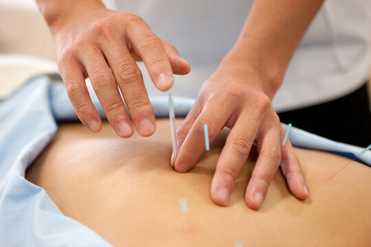 リ・ムーブ鍼灸整体院 【鍼で自律神経調整】全身の鍼施術で自律神経調整　60分　11000円→5480のメニュー画像