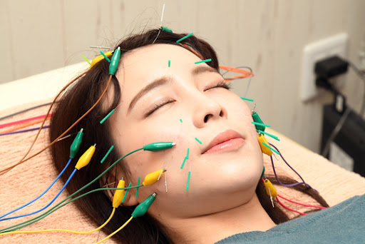 リ・ムーブ鍼灸整体院 【美容鍼でお肌のケア】鍼×パルス施術で肌のターンオーバー促進　60分　10000円→3480円のメニュー画像