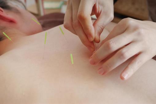 リ・ムーブ鍼灸整体院 全身バランス鍼 — 疲れ・だるさをリセット！のメニュー画像