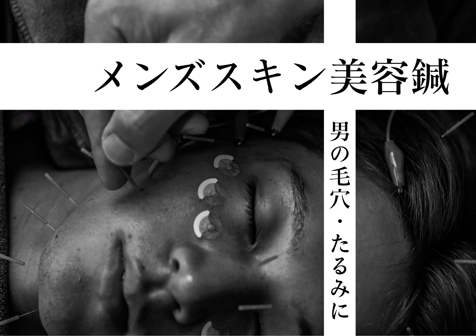 美容とカラダの鍼灸サロン やなけん 亀戸店 《初回限定》男性専用 メンズスキン美容鍼+LEDのメニュー画像