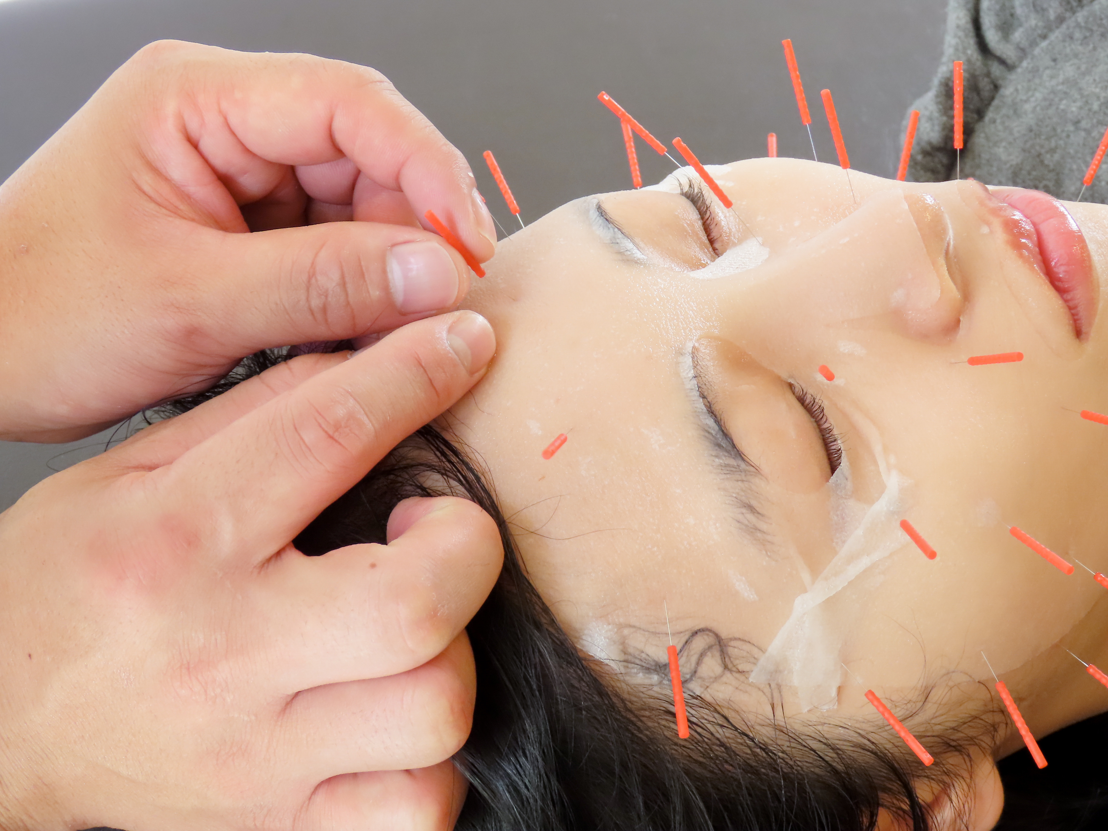 Drハリー 50%off【小顔】【リフトアップ】幹細胞パック＋美容鍼 \22,000のメニュー画像