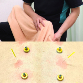 こまち鍼灸整体院Grulla 痛みだけではなく痺れや麻痺にお悩みの方はこちらのメニュー画像