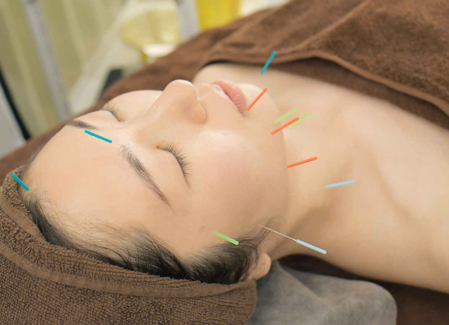 Aire鍼灸院 【掲載サイト限定🎁】美容鍼｜初回半額プラン✨のメニュー画像