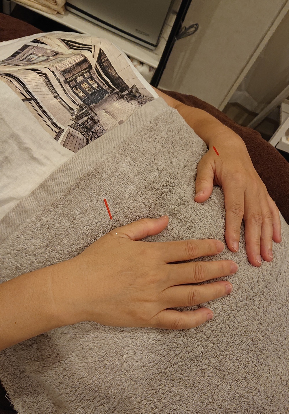 はり灸　Mysig 【期間限定】頭皮鍼×ドライヘッドのメニュー画像