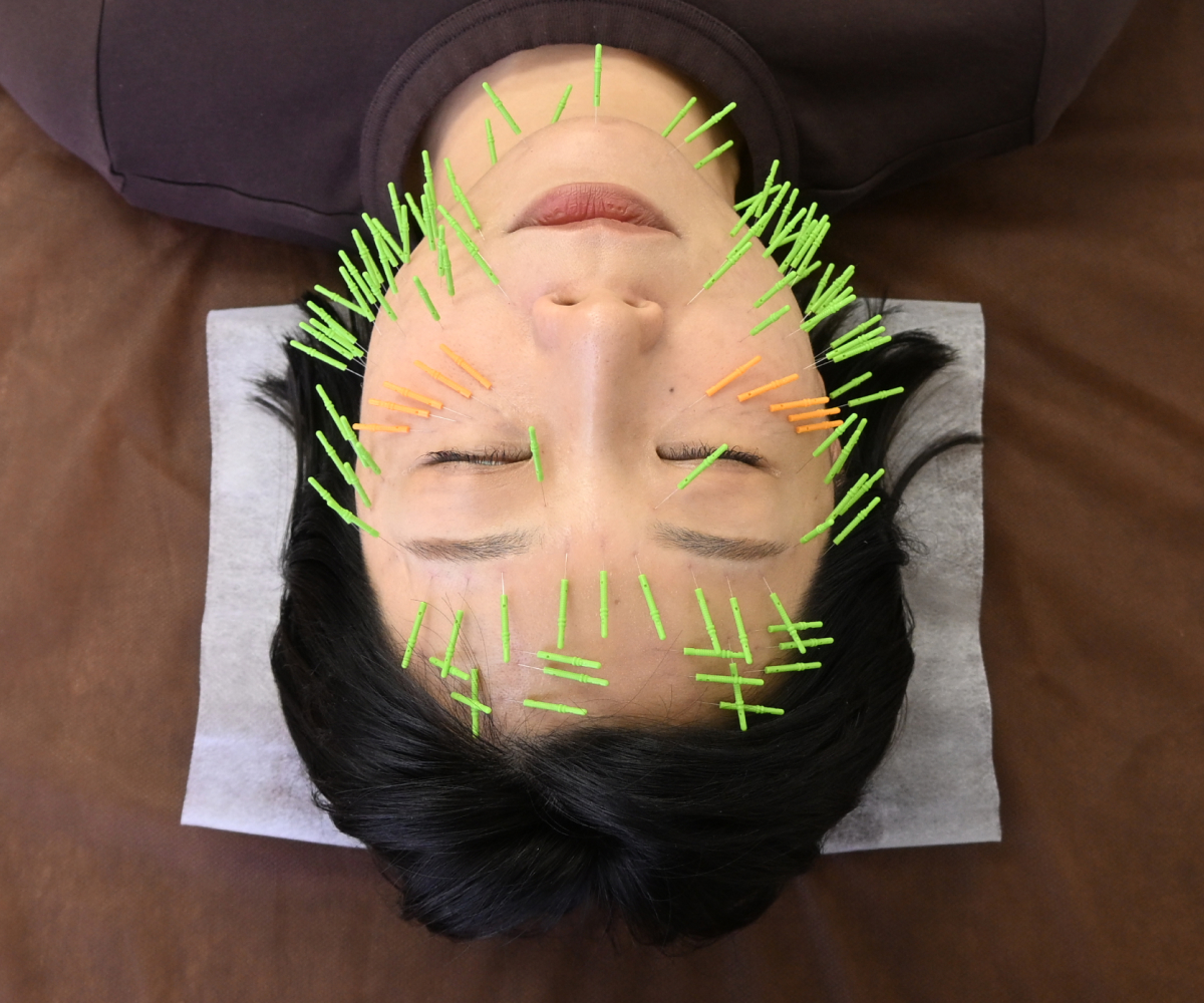 肌質改善専門 美容鍼デイジ―所沢店 贅沢フルコース！プレミアム120本コースのメニュー画像