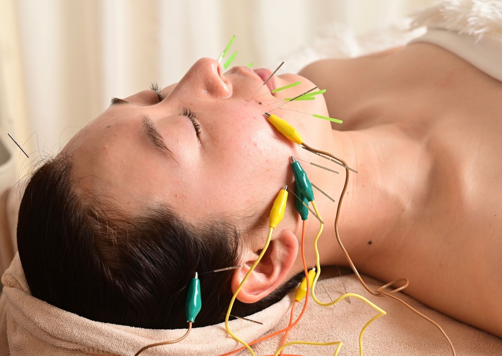 那覇鍼灸サロンrepos［ルポ］ 【電気美容鍼灸】美容鍼＋体質改善のメニュー画像