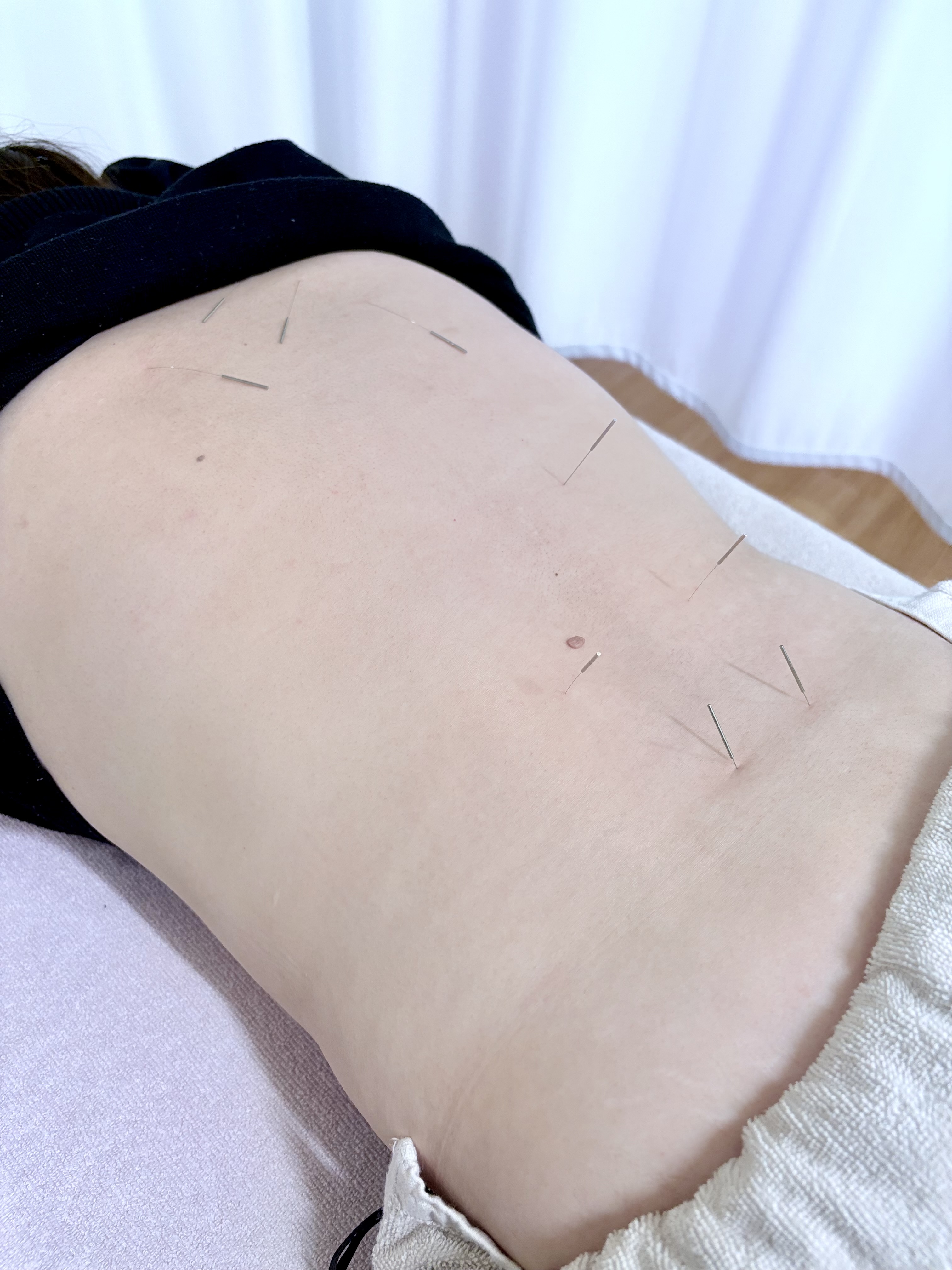 ＴＫ鍼灸治療院 【新規】鍼灸コースのメニュー画像