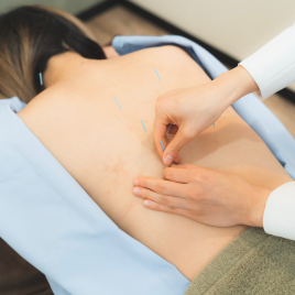 Te to Te 桑名院 体質改善鍼灸治療のメニュー画像