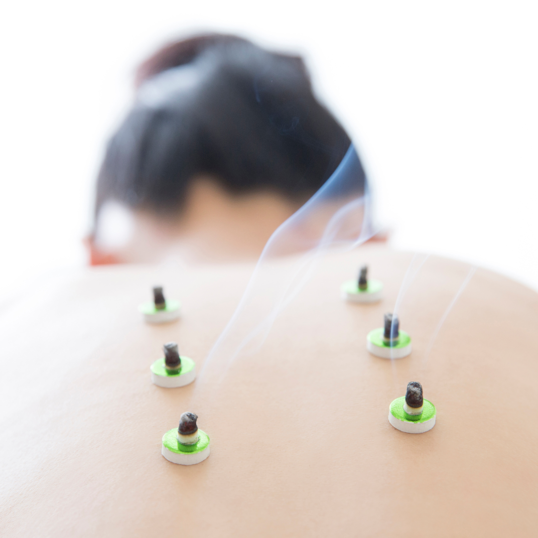 DPLスポーツ鍼灸院 伝統鍼灸施術コースのメニュー画像