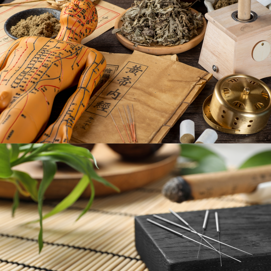 DPLスポーツ鍼灸院 【新規】伝統鍼灸施術コースのメニュー画像