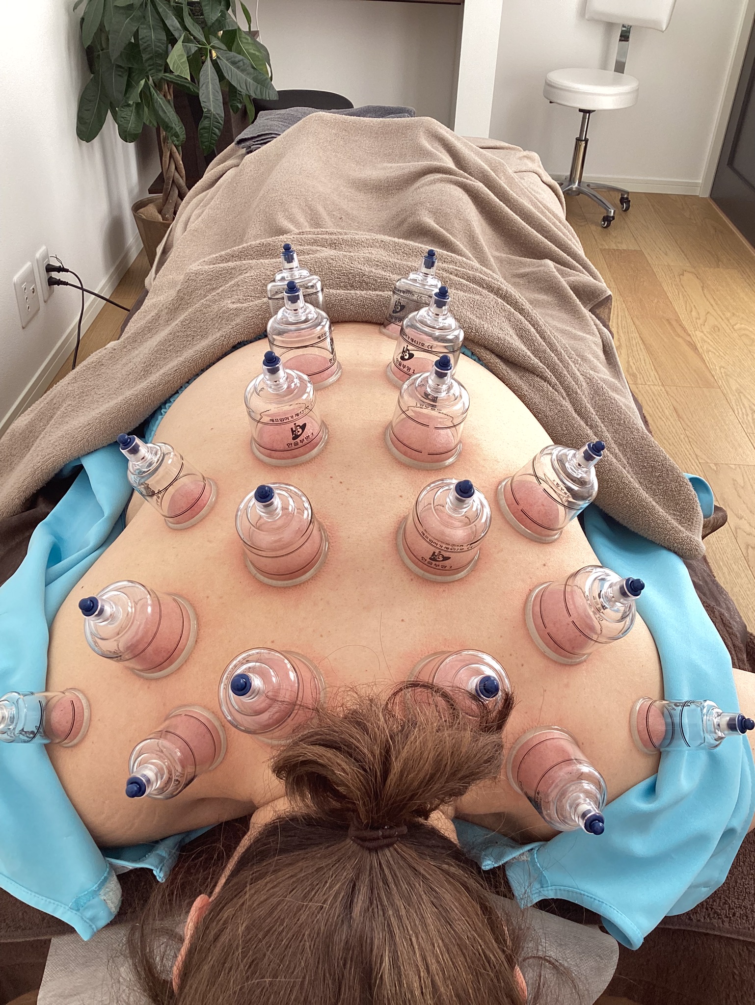 リラクゼーション鍼灸 HARIOKA カッピングのメニュー画像