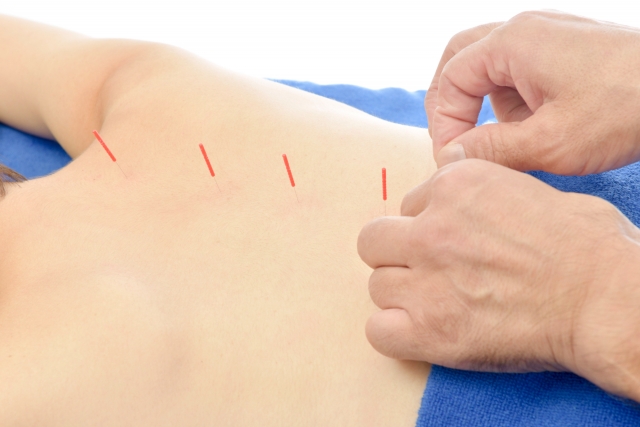 やんばはりきゅう治療院 はりきゅう治療のメニュー画像