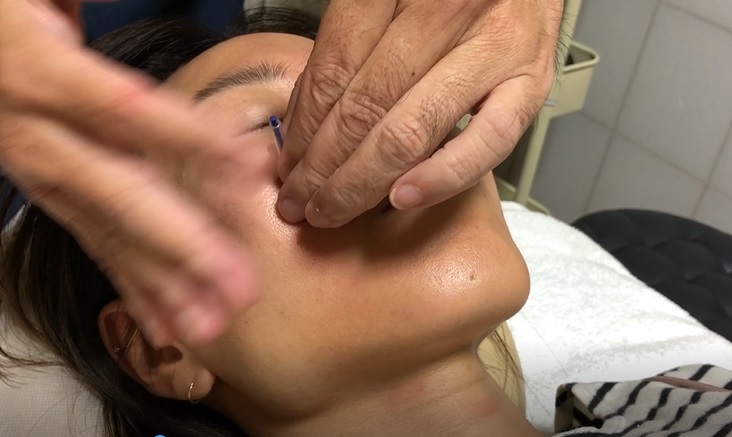 やんばはりきゅう治療院 美顔はりのメニュー画像