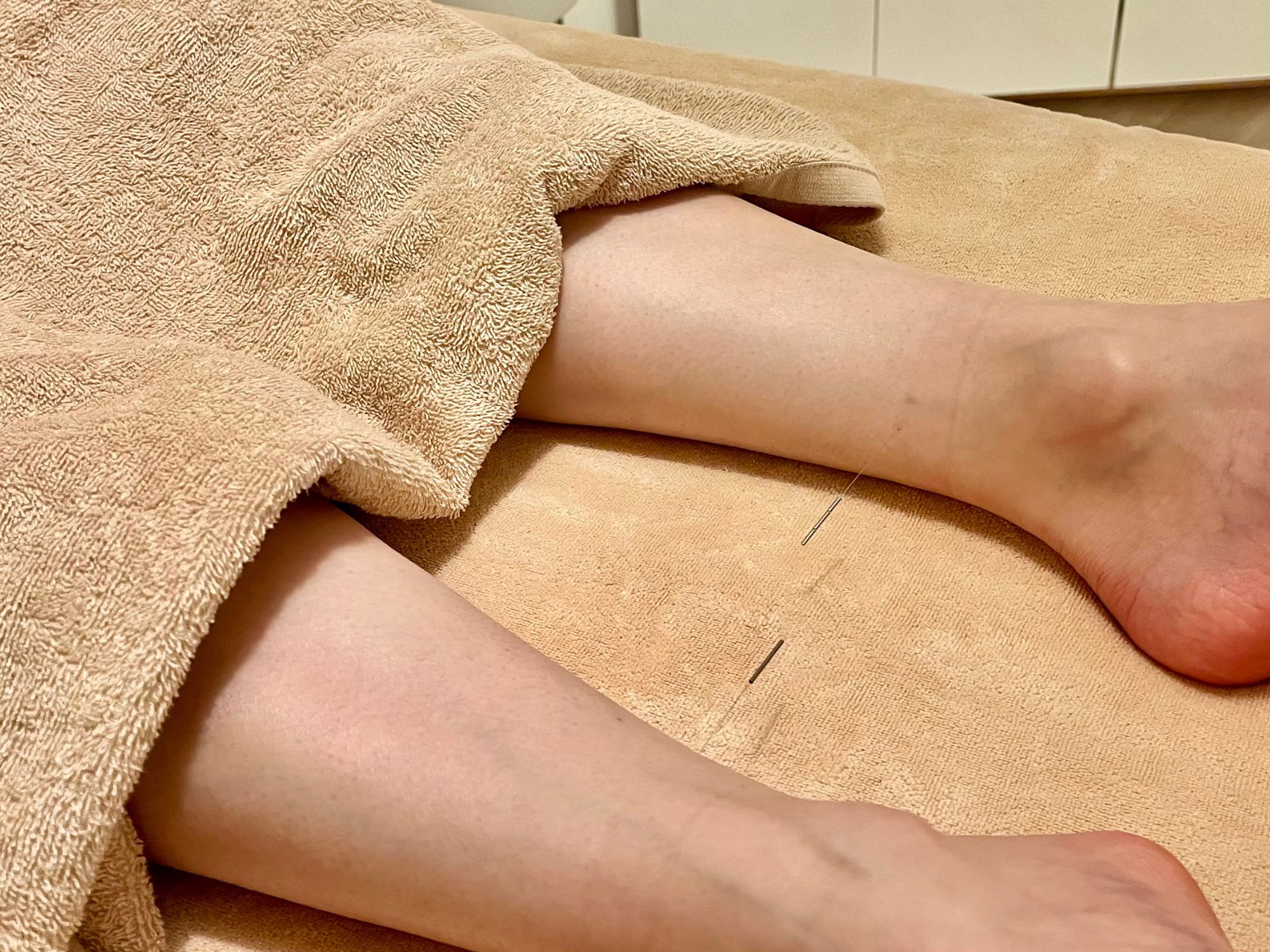 はりとお灸　ひととき ひとときケアのメニュー画像