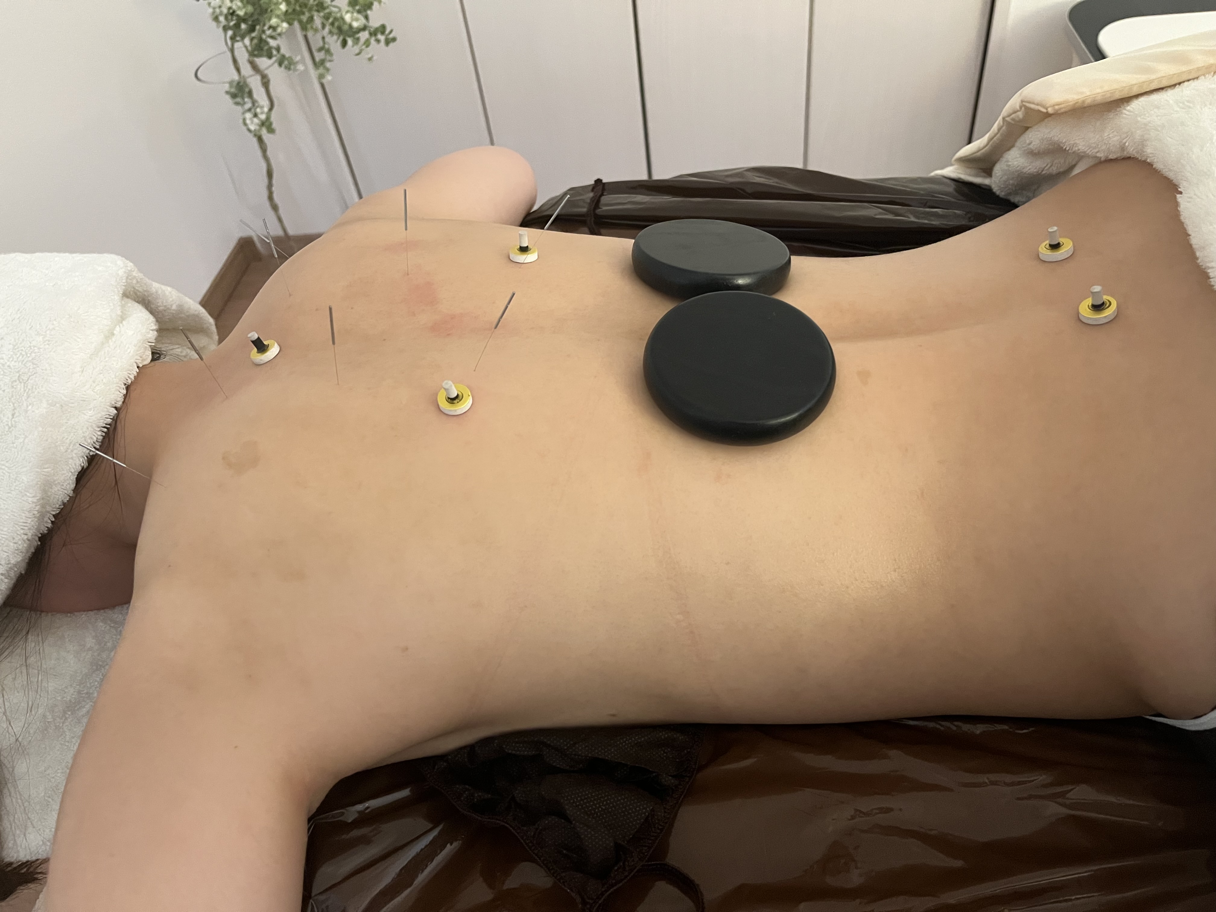 鍼灸院 Anju レディース鍼灸のメニュー画像