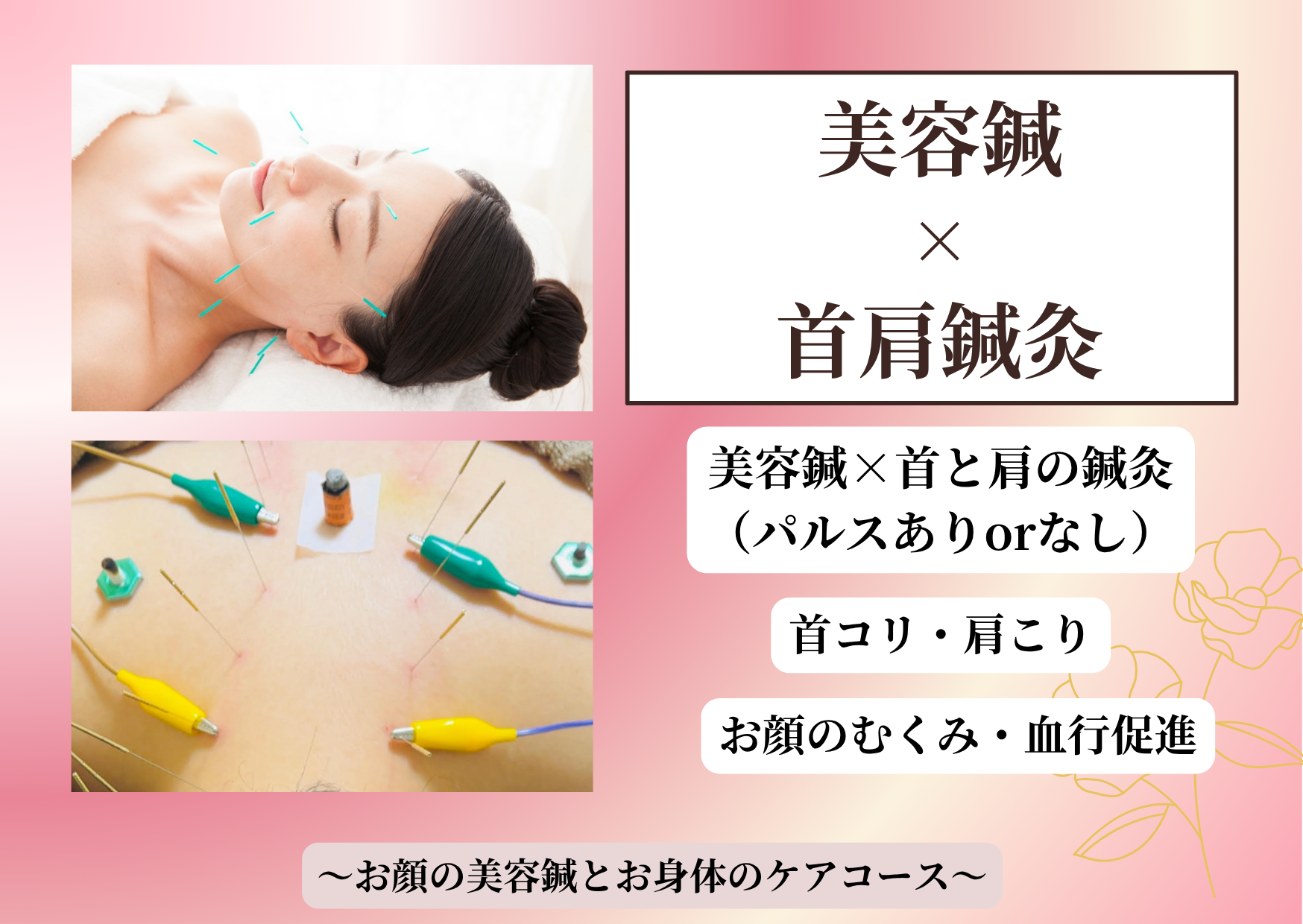ゆり鍼灸院 美容鍼と首肩鍼灸のメニュー画像