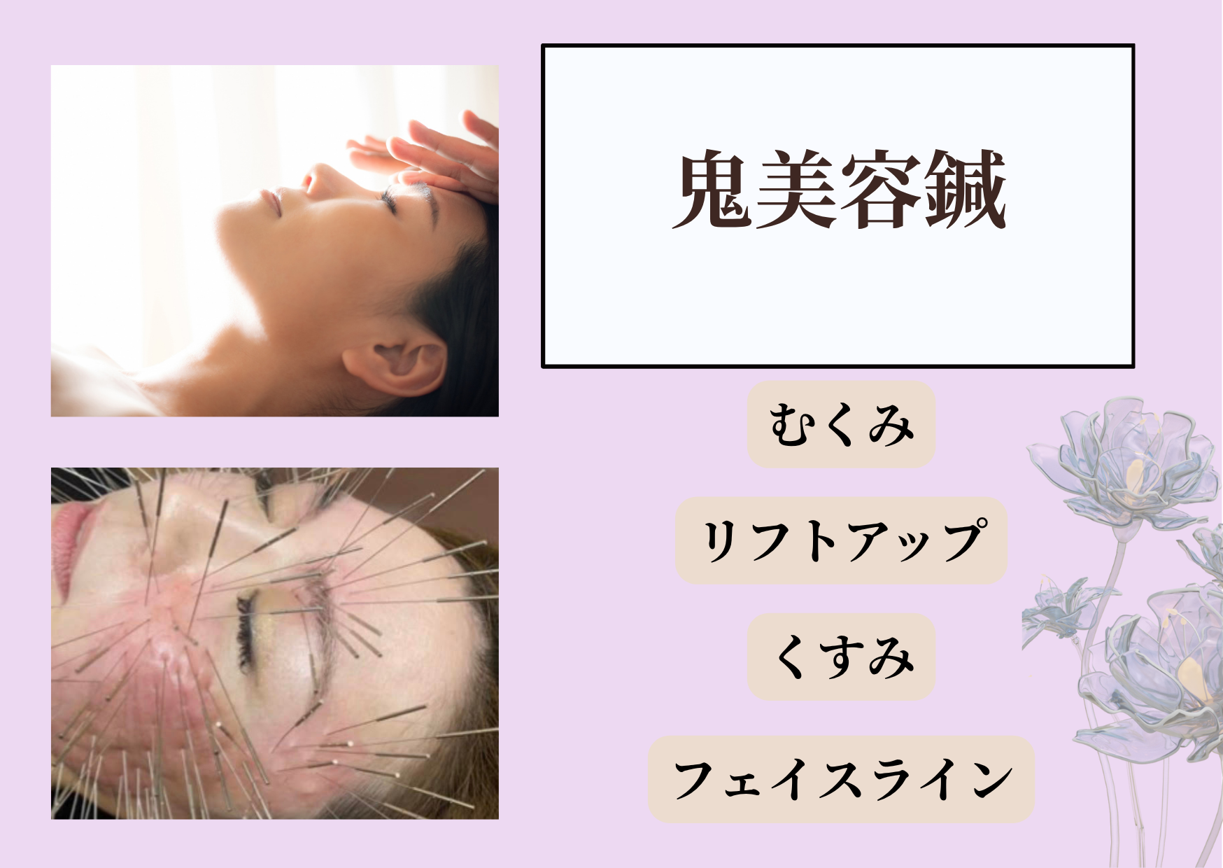 ゆり鍼灸院 鬼美容鍼（ルート鍼）・30分枠のメニュー画像