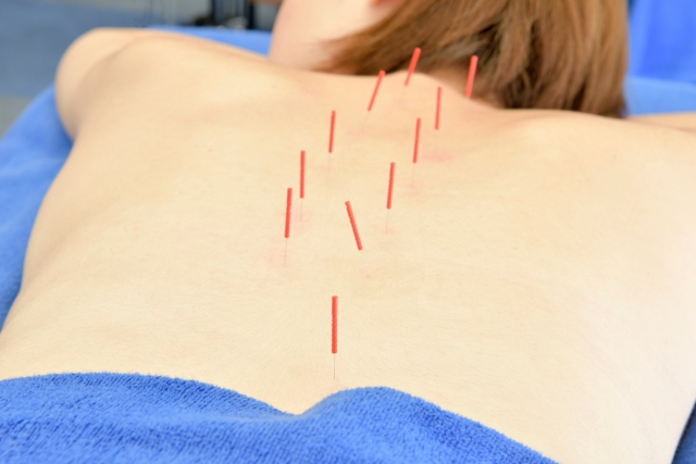 はりきゅう整体ふじ 【大塚未来堂様:月・金】はりきゅうコース（はりきゅうのみ※美容はりは含みません）のメニュー画像