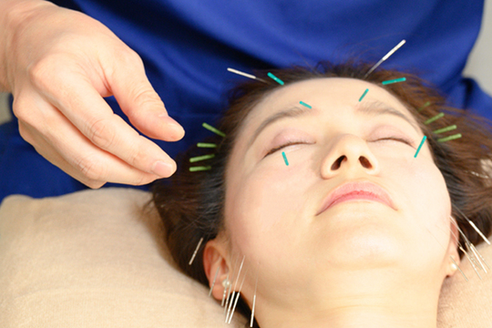はり灸院こうえい 【毛穴・肌質改善対応】美容鍼スキンリニューアルコースのメニュー画像