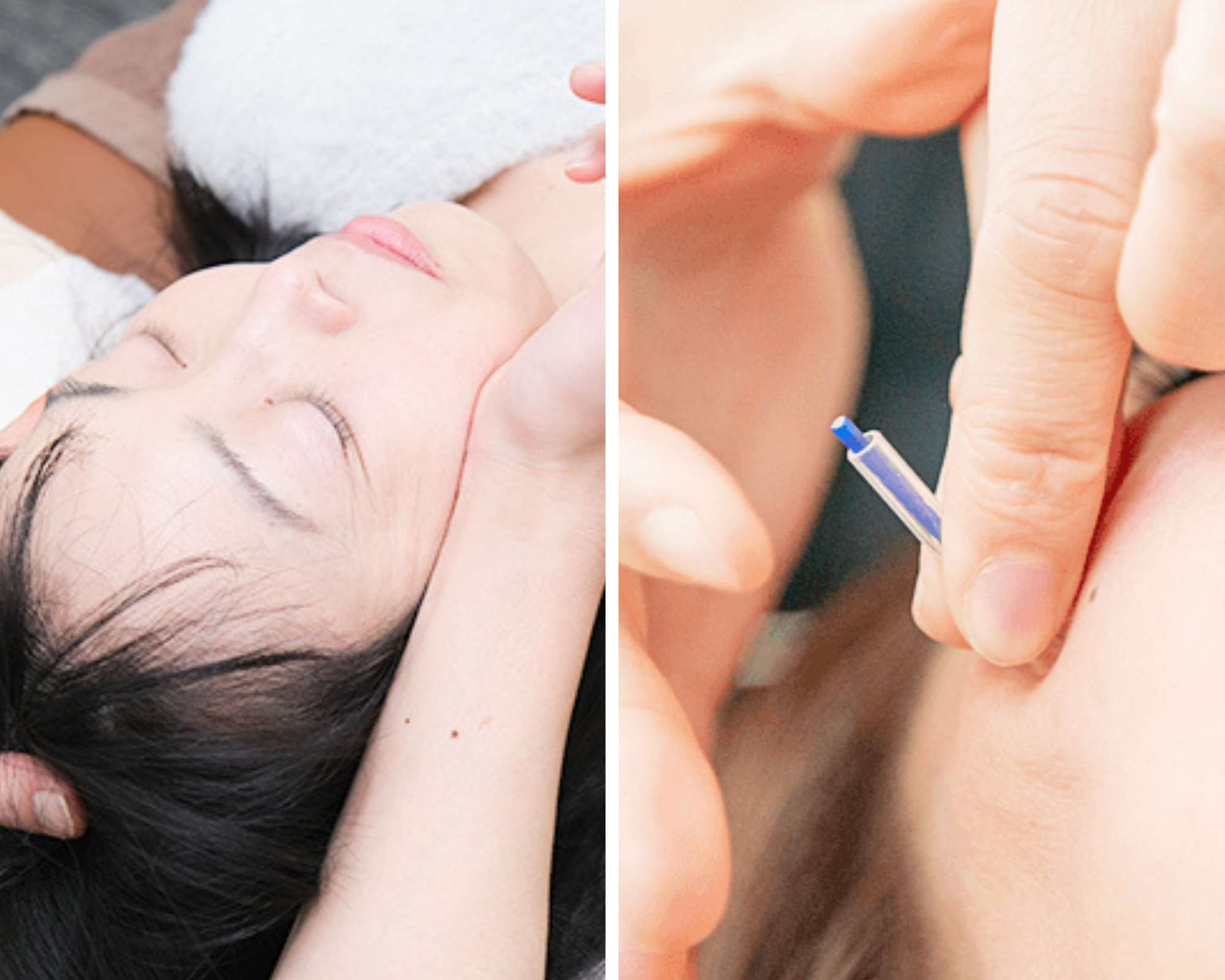 かみなかひかり鍼灸院接骨院 肌再生プレミアムのメニュー画像