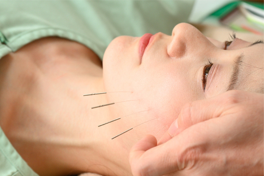 はり灸院こうえい 美容鍼灸スタンダード80のメニュー画像