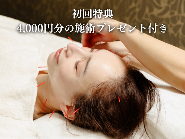 カリスタ恵比寿本店 【初めての方限定】パーフェクトリフトケア美容鍼（お顔）のメニュー画像