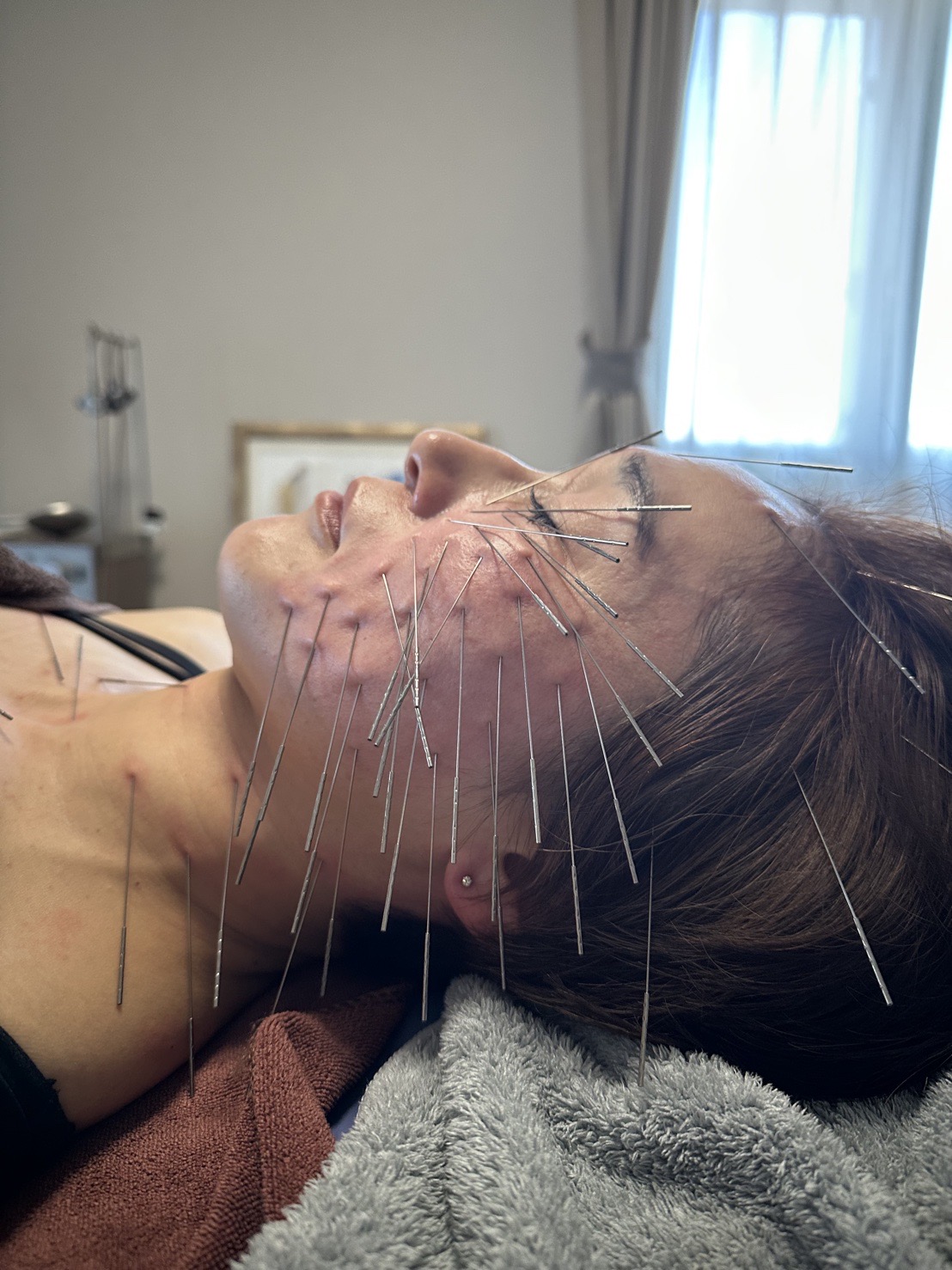 Conditioning Space nana.iro ルート鬼美容鍼40分のメニュー画像