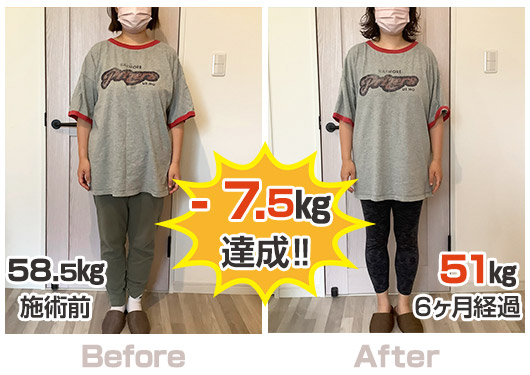 【美容鍼・育毛鍼】きよもと鍼灸院 【自己流で1kgも痩せなかったら】体質改善ダイエットプログラム初回カウンセリング(しんきゅうコンパス限定価格)のメニュー画像