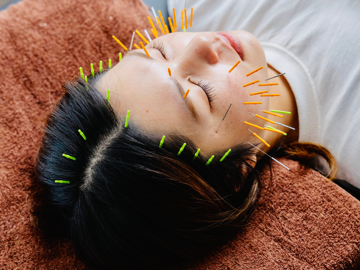 HARIS美容鍼灸整体院 【人気No.１】お顔の悩みを改善！プレミアム美容鍼コース　初回60分　¥11000→¥5000のメニュー画像