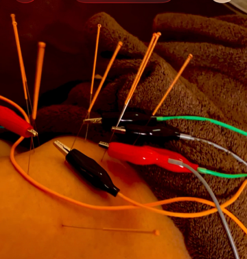 土田はり灸院 再来の方　パルス通電電気鍼コース45分のメニュー画像