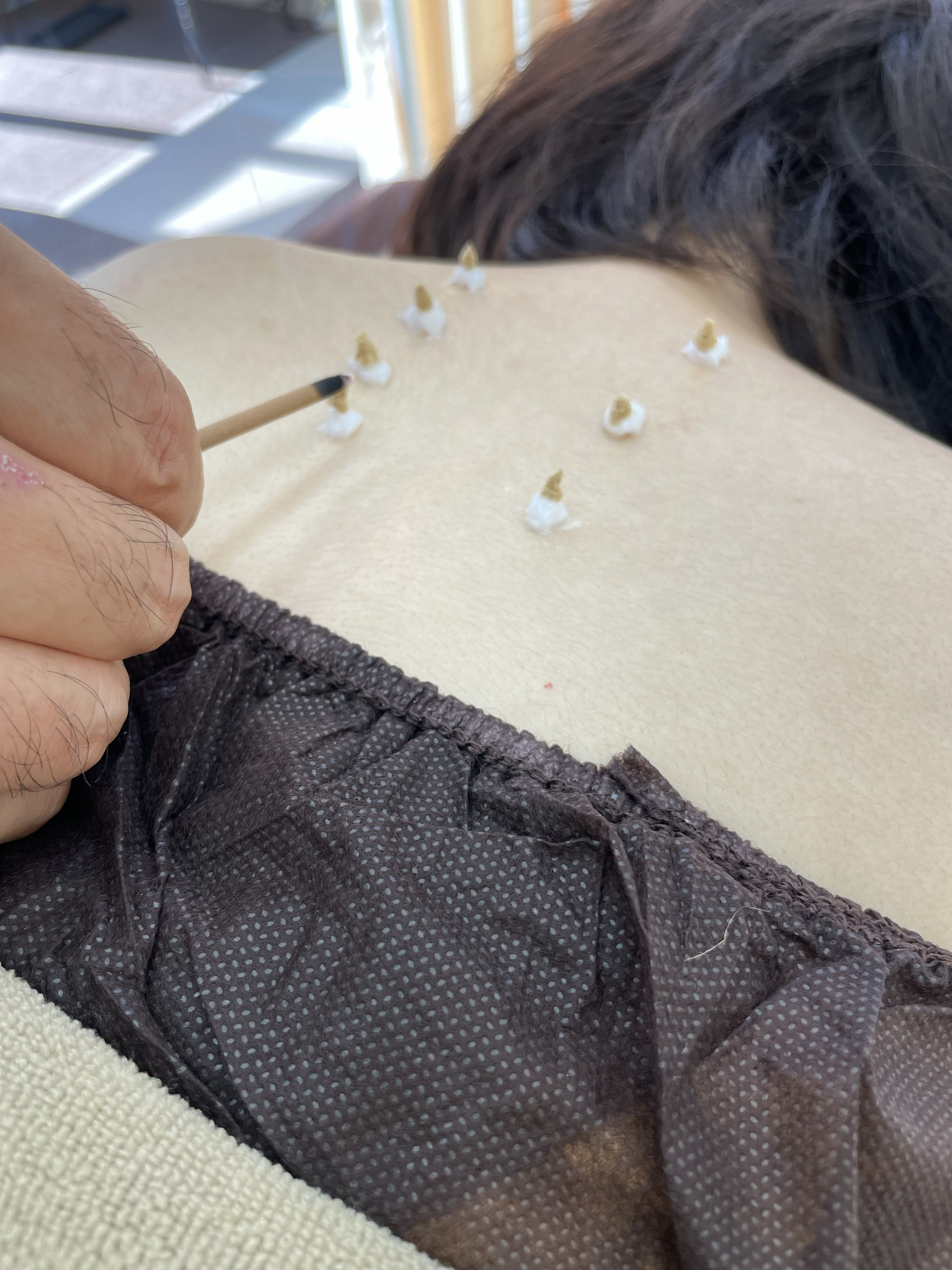 小田急相模原あんま鍼灸院Zen 鍼灸スタンダードのメニュー画像