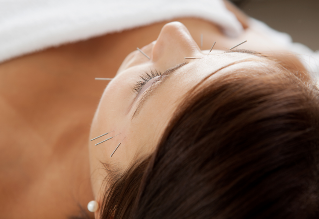 鍼灸サロン　はりルーチェ No.1 リフトアップ美容鍼（小顔マッサージ＋アロマヘッドスパ）のメニュー画像