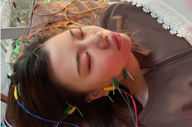 鍼灸サロン　はりルーチェ ほうれい線集中美容鍼（電気美容鍼＋表情筋アプローチ）のメニュー画像