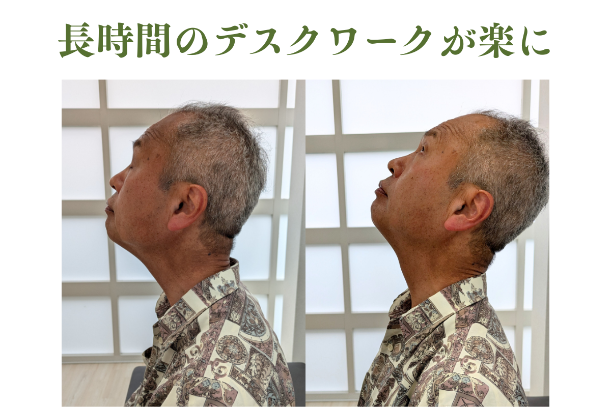 はりきゅうeFu -エフ- 【2回目以降】首・肩・背中の治療のメニュー画像