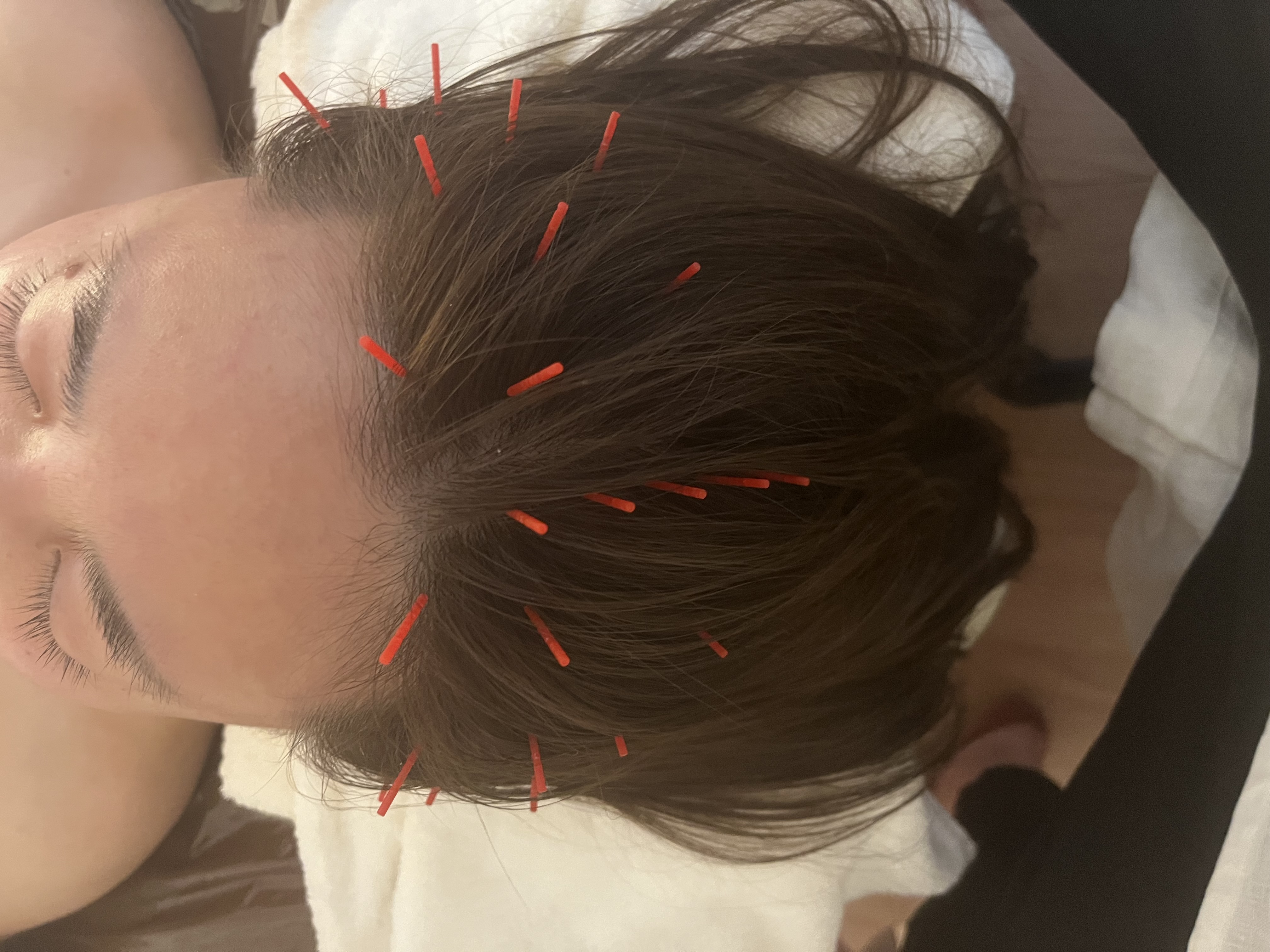 鍼灸院 Anju 頭毛トリートメントのメニュー画像
