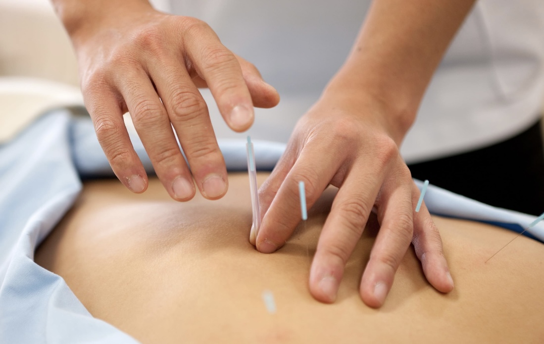 HaRRies 【キャンペーン中】鍼灸施術（全身調整）のメニュー画像