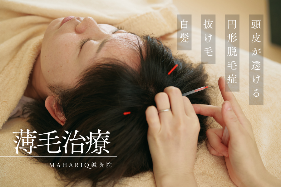 マハリク鍼灸院 薄毛鍼灸治療（５回分回数券）のメニュー画像