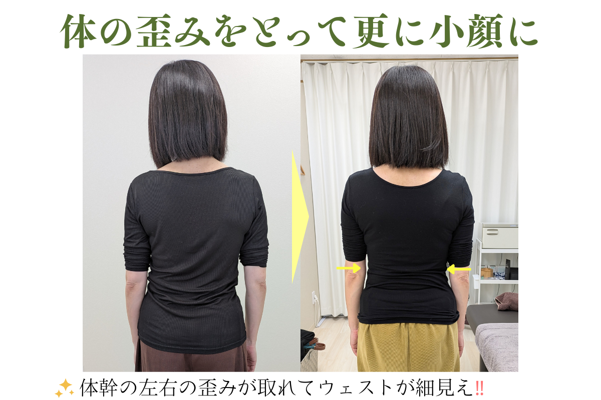 はりきゅうeFu -エフ- 【新規】美容鍼＋美容整体｜体の歪みをとって小顔効果を引き上げる施術のメニュー画像