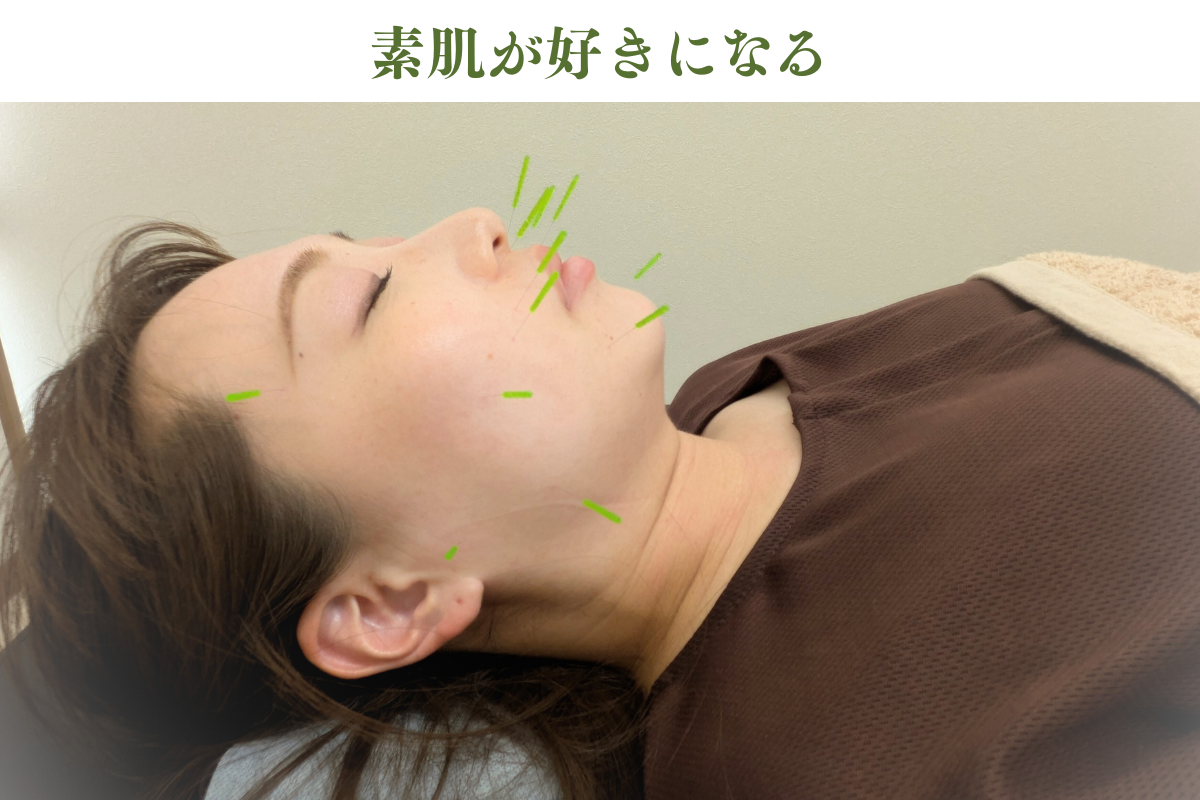 はりきゅうeFu -エフ- 【新規】アンチエイジング美容鍼｜若返り集中美容鍼/2回目以降5,000円のメニュー画像