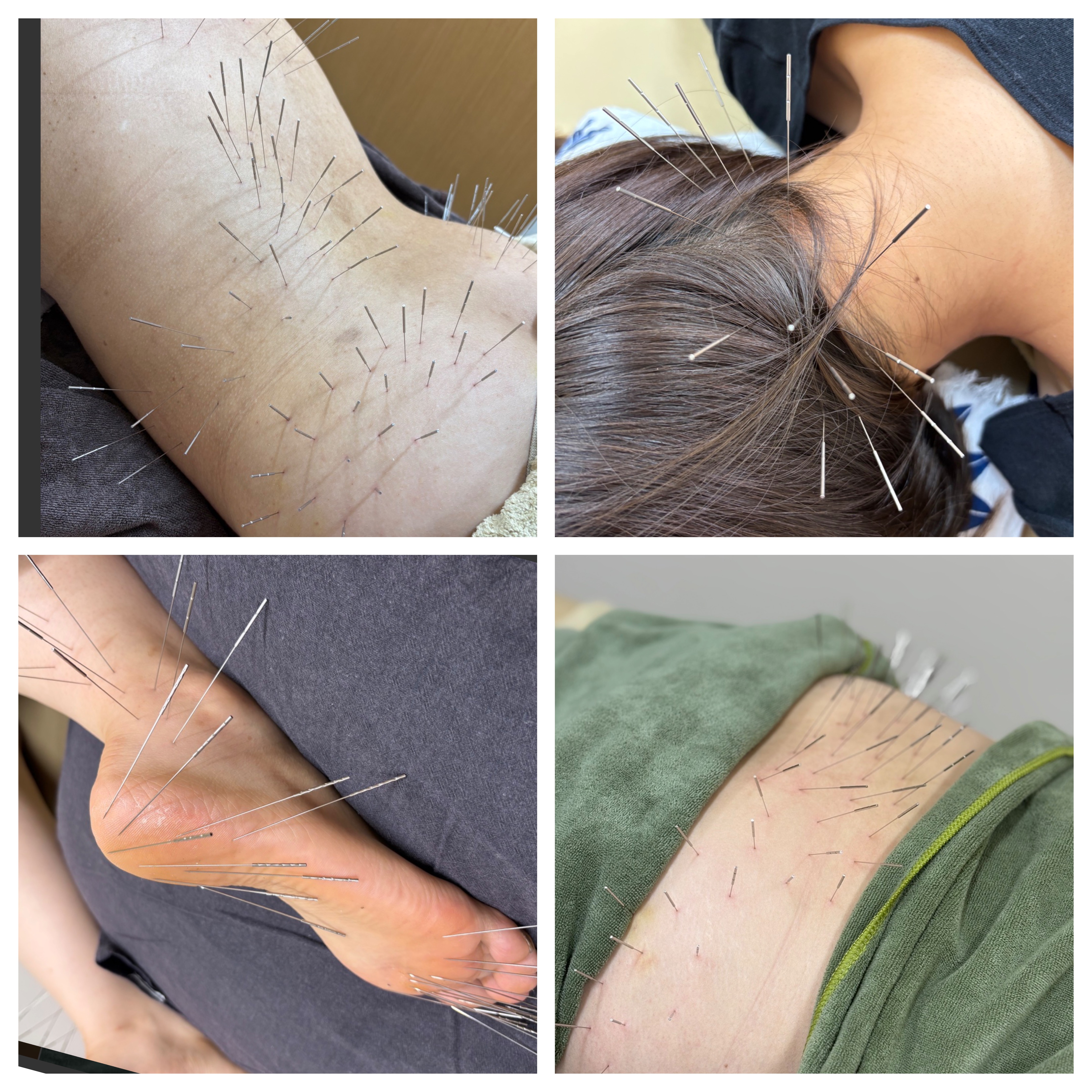 ルート治療専門　ながえ鍼灸院 ルート治療60分☆婦人科系疾患・妊活お灸付き☆のメニュー画像