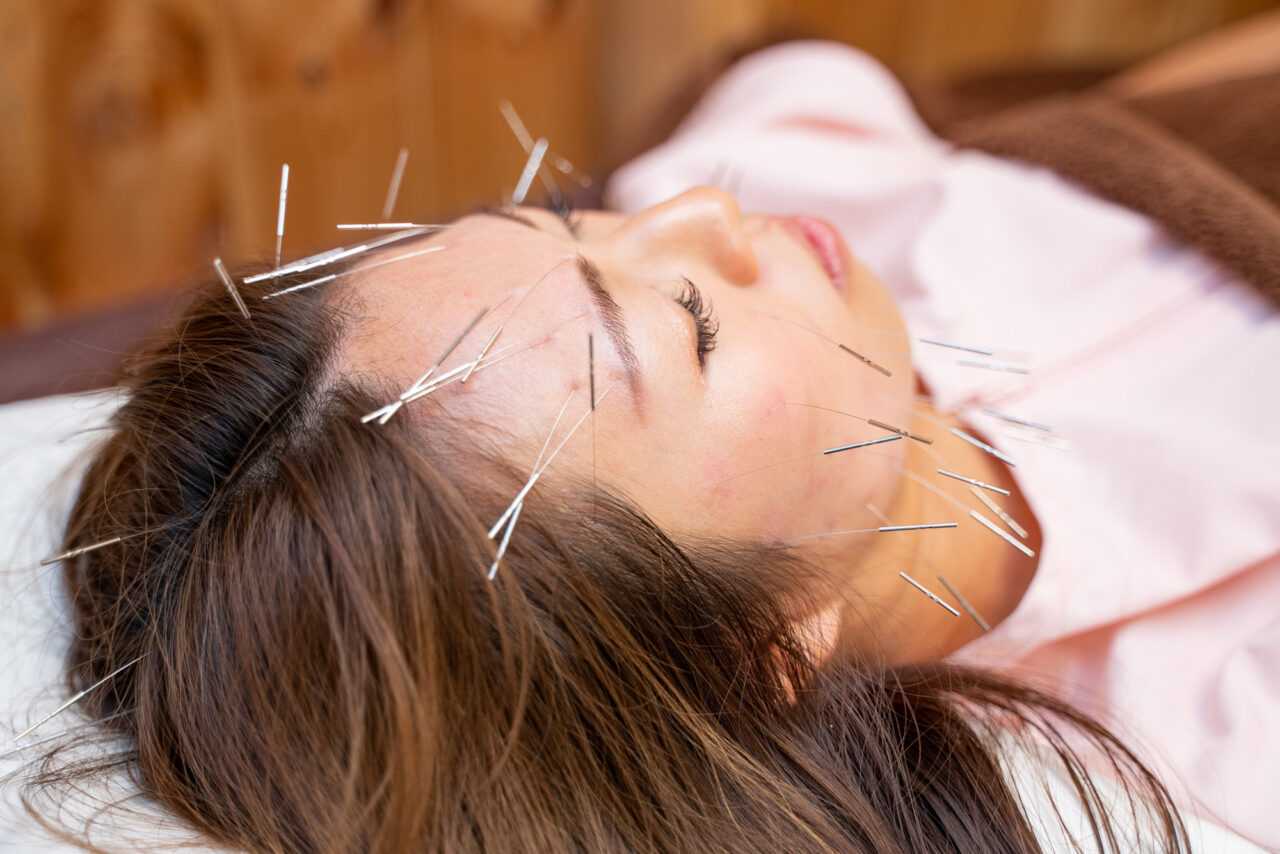 美容鍼サロン ボディコンディション 【美容鍼＋身体】小顔×全身デトックスでたるみ改善のメニュー画像