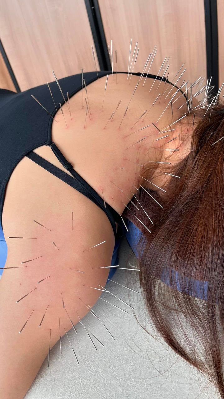 鍼秋田別院〜ルート治療専門院〜 ルート鍼　60分のメニュー画像