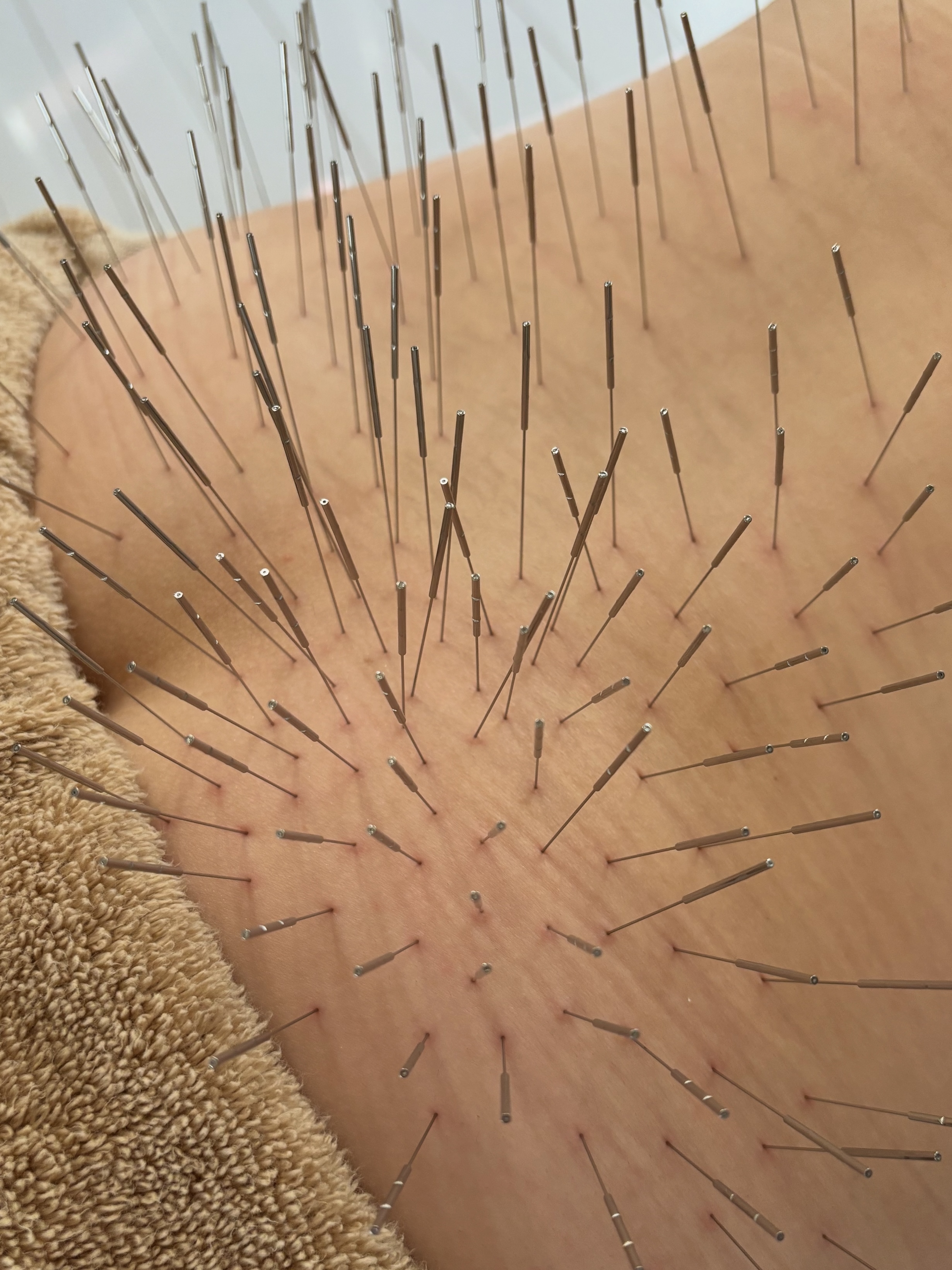 鍼秋田別院〜ルート治療専門院〜 婦人科集中コースのメニュー画像