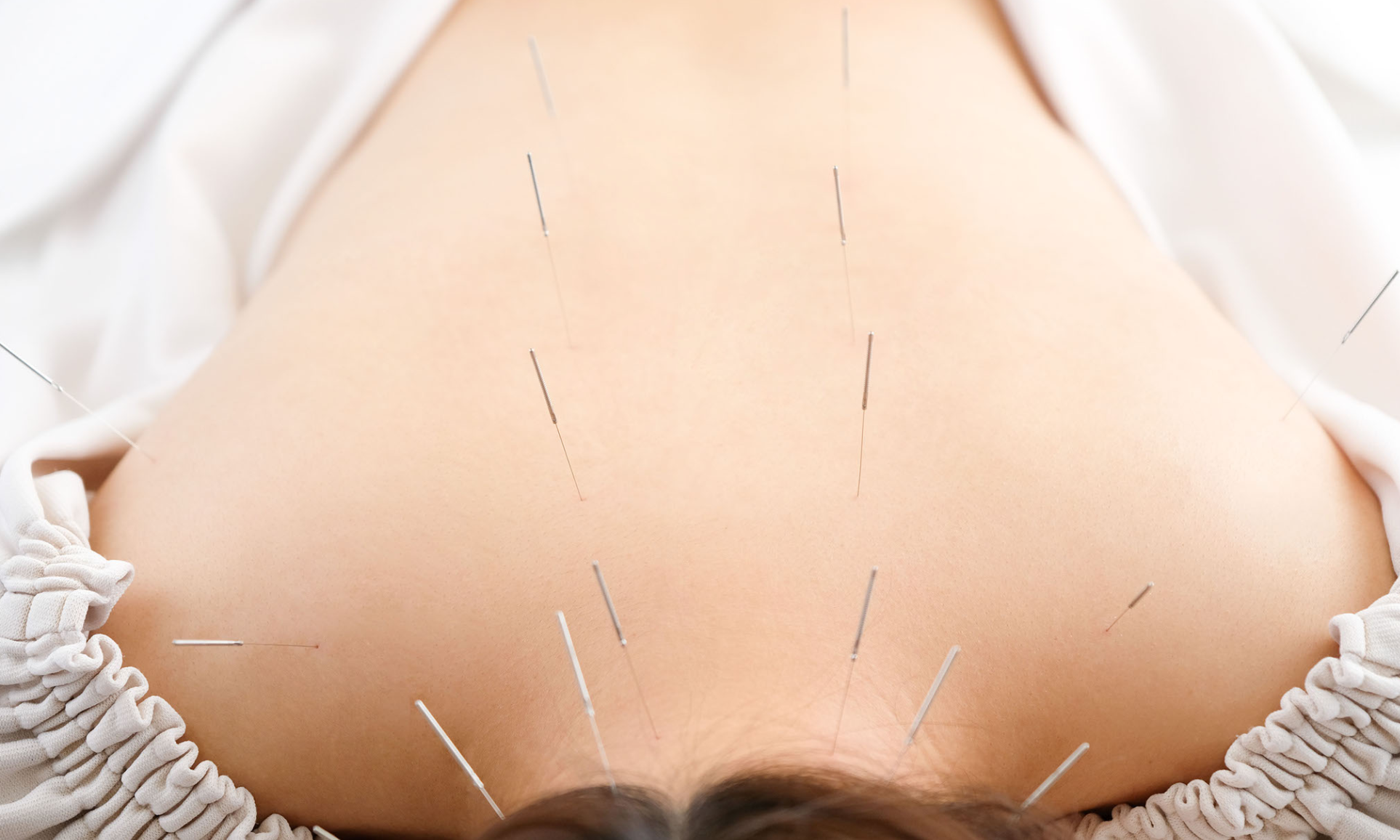 鍼灸院　和 全身改善コースのメニュー画像