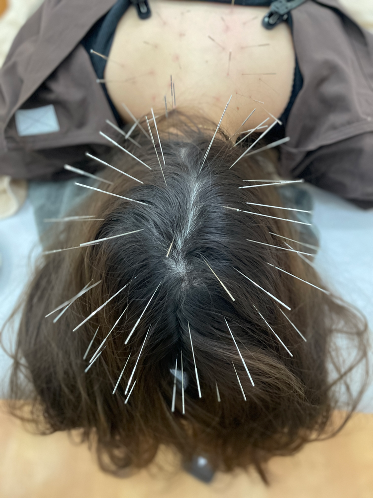 やまもと鍼灸整骨院(ルート治療）和泉市 初めてルート治療を受けられる方のメニュー画像