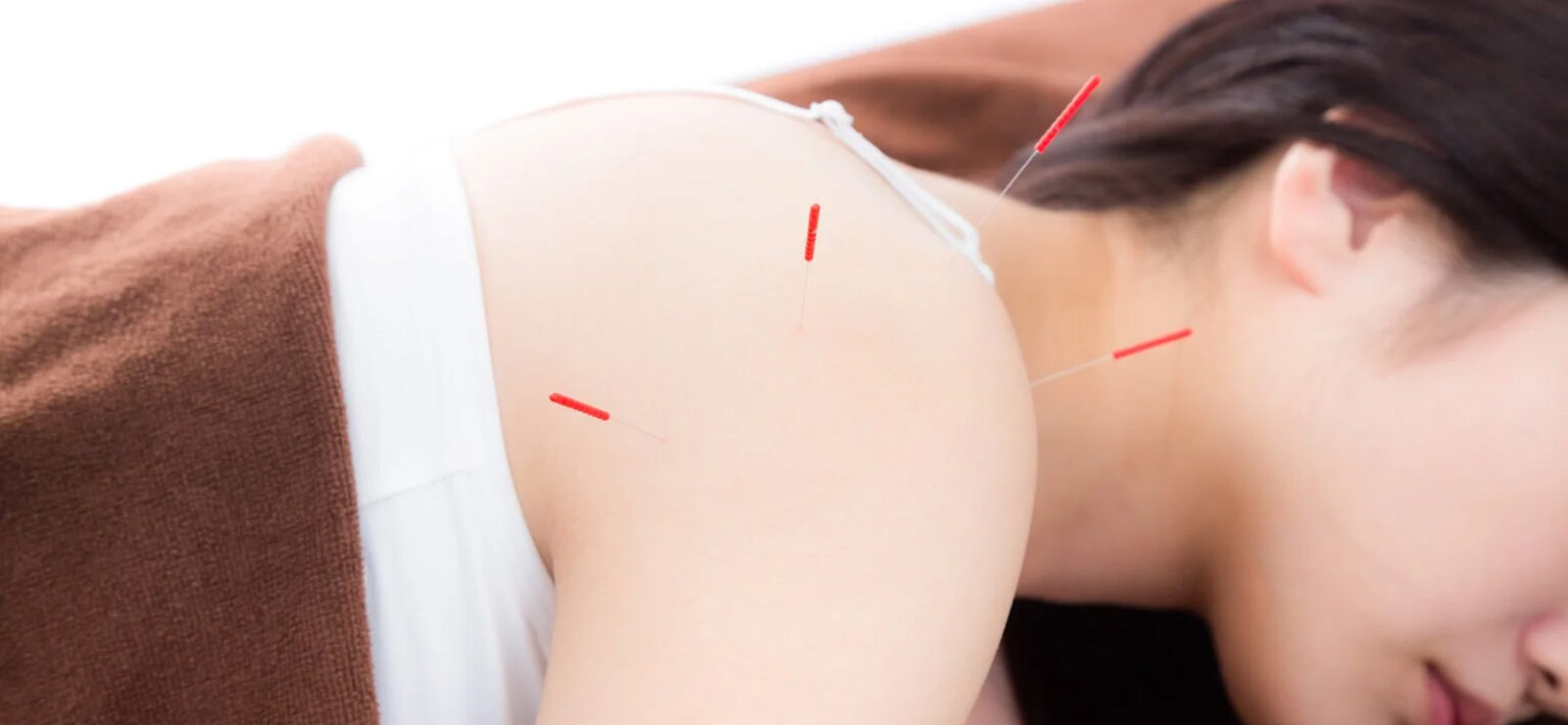 さくら鍼灸院・接骨院相模大野院 【鍼施術（自費施術）】のメニュー画像